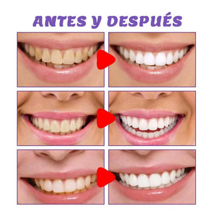 VioletSmile pasta dental morada V34